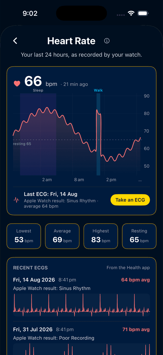 The Heart Rate screen: a 24-hour heart rate line with sleep and walk periods marked, above a list of recent ECG recordings.